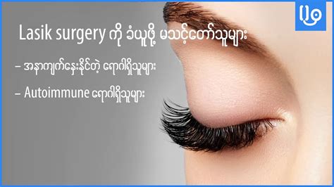 Lasik Eye Surgery Youtube