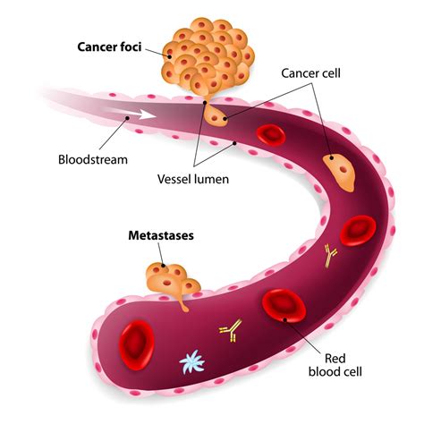 The Adaptive Cancer Cell How Metastases Evolve To Resist Treatment