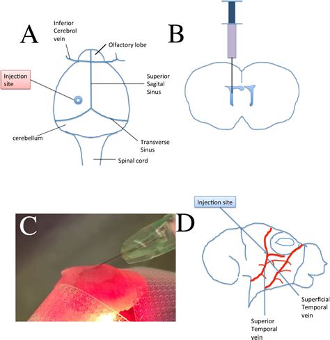 Intracerebroventricular And Intravascular Injection Of Viral Particles
