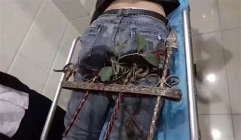 Man Gruesomely Impaled After Falling Bum First Onto Spiked Railings