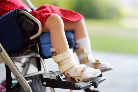 How Medical Malpractice May Cause Cerebral Palsy Hale And Monico