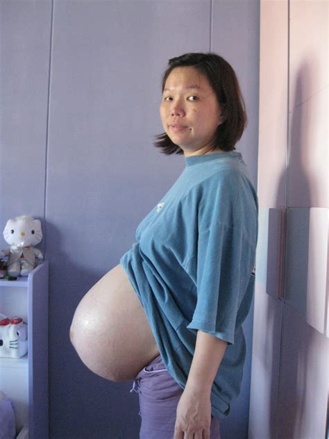 Sanmao 随想 Twin Pregnancy Week 36 10th Dec 2011