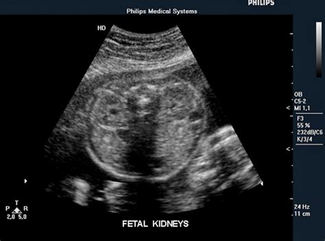 Fetal Ultrasound Image Gallery Imaging Technology News