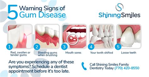 How To Identify The Early Signs Of Periodontal Disease Shining Smiles
