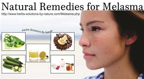 10 Natural Remedies For Melasma That Have Been Proven To Work Herbs