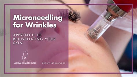 Microneedling For Wrinkles Wilderman Cosmetic Clinic