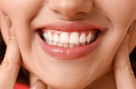 A Useful Guide You Need To See Before Gum Bleaching Treatment Maltepe