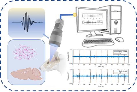 Frontiers An Optimized Miniaturized Ultrasound Transducer For