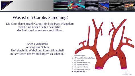 Carotis Sceenings Trainings Zentrum Ultraschall Diagnostik Youtube