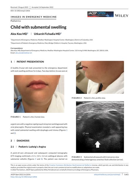 Pdf Child With Submental Swelling