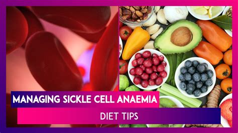 World Sickle Cell Day 2020 Know How To Manage Sickle Cell Anaemia With