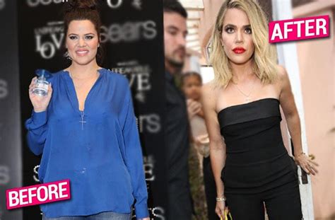 Khloe Kardashian Looks Scary Skinny After Extreme Weight Loss Is She