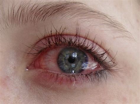 New Post On Narcotic Crying Eyes Aesthetic Eyes Crying Aesthetic