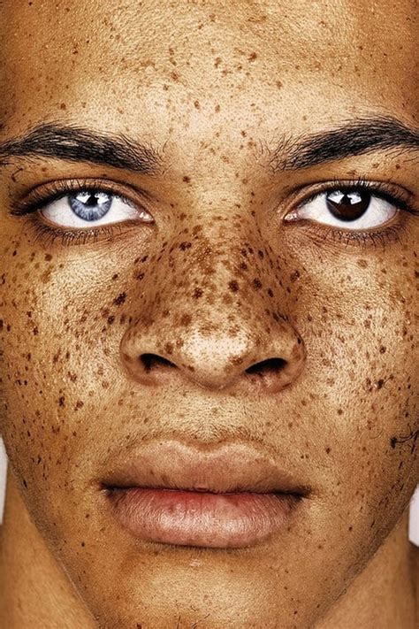 Makeup Beauty Hair And Skin These Photos Of Freckles Will Make You