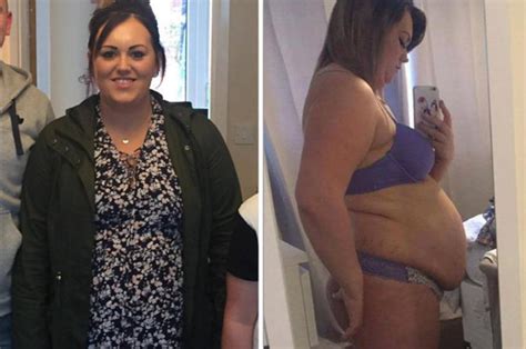 Obese Woman Shamed Into Losing Weight You Wont Believe What She