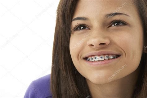 Девушки с брекетами на зубах 27 фото