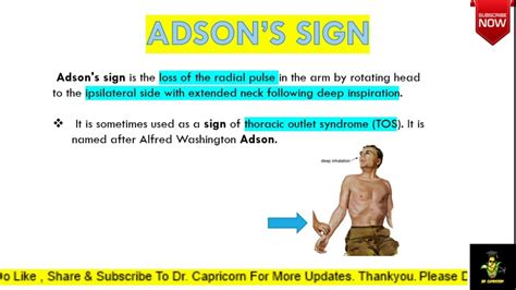 Adsons Test For Thoracic Outlet Syndrome Captions More