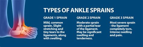 What Grade Of Ankle Sprain Do I Have