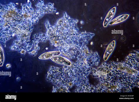 Paramecium In Pond Water Under Optical Microscope Stock Photo Royalty