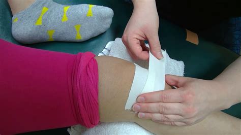 Mcconnell Taping For Patella Youtube