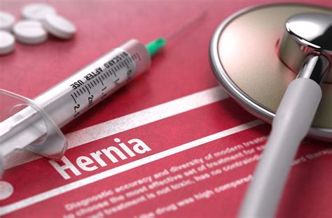 Hernia Mesh Lawsuit Complications Failure And Recall Top Class Actions