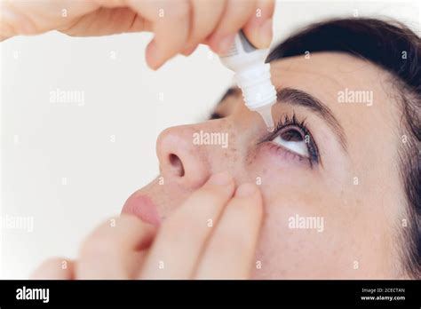Woman Using Eye Drop Woman Dropping Eye Lubricant To Treat Dry Eye Or Allergy Sick Girl