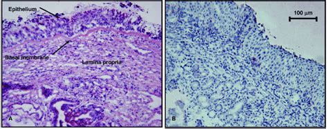 He Staining And Negative Control Of Nasal Mucosa Light Microscopic