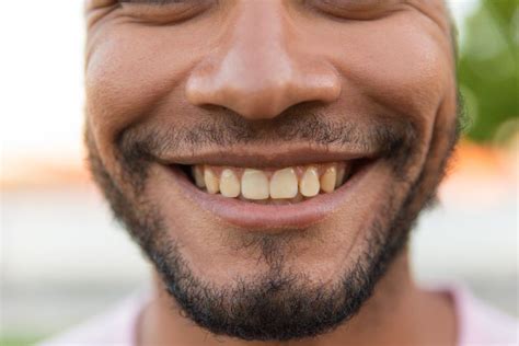 how to get rid of coffee and cigarette stains on teeth how can you get control of yellow teeth