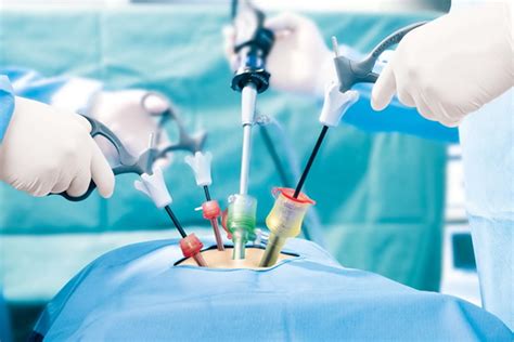 How Laparoscopic Surgery Has Taken Over Open Surgery1 Beranisehat