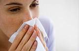 Images of Can Gerd Cause Nasal Congestion
