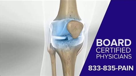 Arthritis Relief Centers Tv Commercial Knee Arthritis Treatment