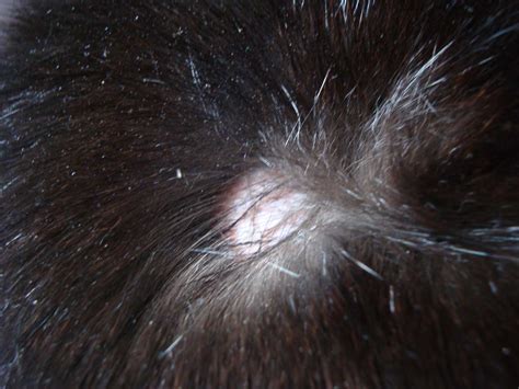 My Cat Has Got Two Bald Patches On His Back Both At Similar Heights On