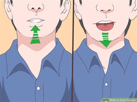 5 Ways To Cure Hiccups Wikihow
