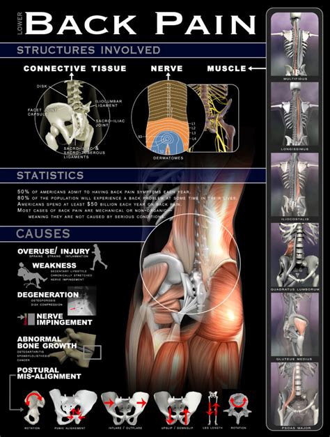 Lower Back Pain Why How And Where Infographic