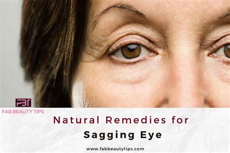 Natural Remedies For Sagging Eyes