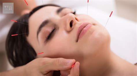 Acupuncture Facts What Does Acupuncture Help With