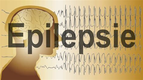 Erste Hilfe Bei Einem Epileptischen Anfall