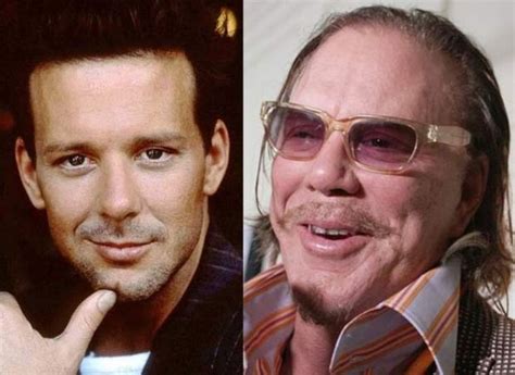 Mickey Rourke Plastic Surgery He Lost His Good Looks After Years Of