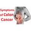 WARNING SIGNS OF COLON CANCER YOU MUST KNOW  Health Nourishment