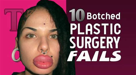 Our Top Ten List Of Botched Plastic Surgery Fails Has The Most