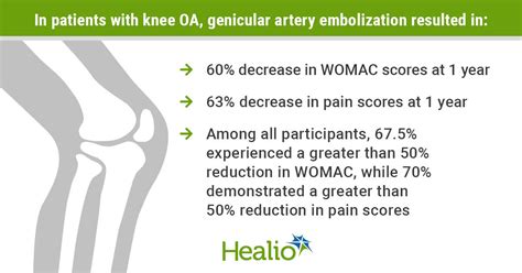 Genicular Artery Embolization Highly Effective In Reducing Knee Oa Pain