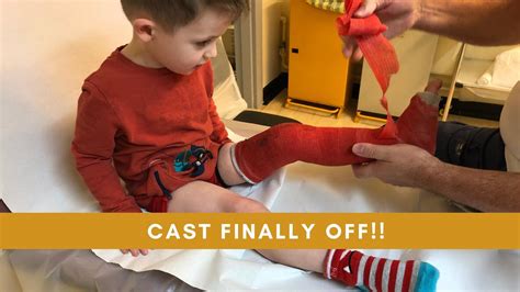 Harry Finally Gets His Cast Off After 6 Weeks Toddler Full Leg Cast