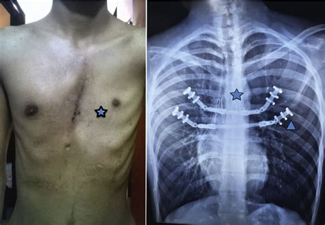 Simple Science: How to Make a Volcano with Kids