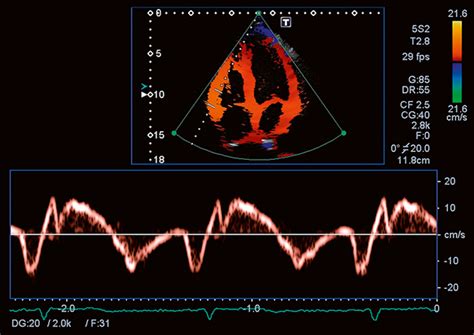 Cardiology Clinical Segment Ultrasound Canon Medical Systems Usa