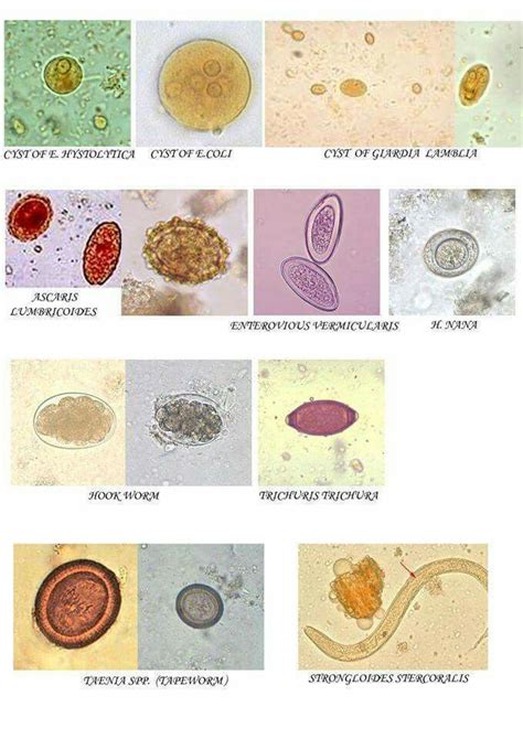 Life Cycle Of Entamoeba Histolytica Artofit