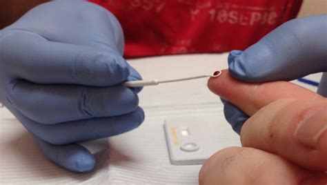 When evaluating a patient's need for testing and discussing one's status and risk factors, it. New HIV Testing Methods Offer Faster Treatment ...