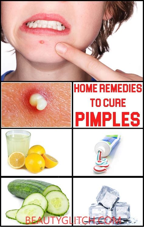 Acne And Also Acne Remedies Natural Means To Get Rid Of As Well As