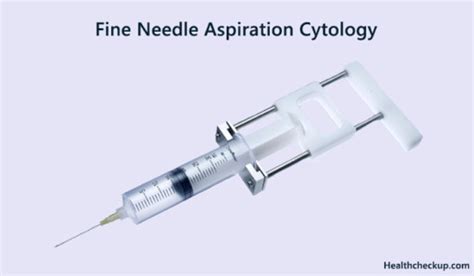 Fine Needle Aspiration Cytology Preparation Procedure Results