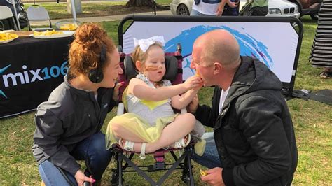 Lemon Face Challenge Annabelle Potts Fights To Raise Funds For Brain
