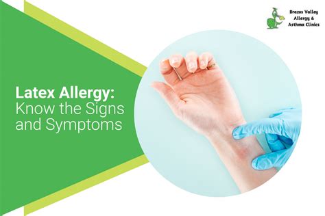 Latex Allergy Know The Signs And Symptoms